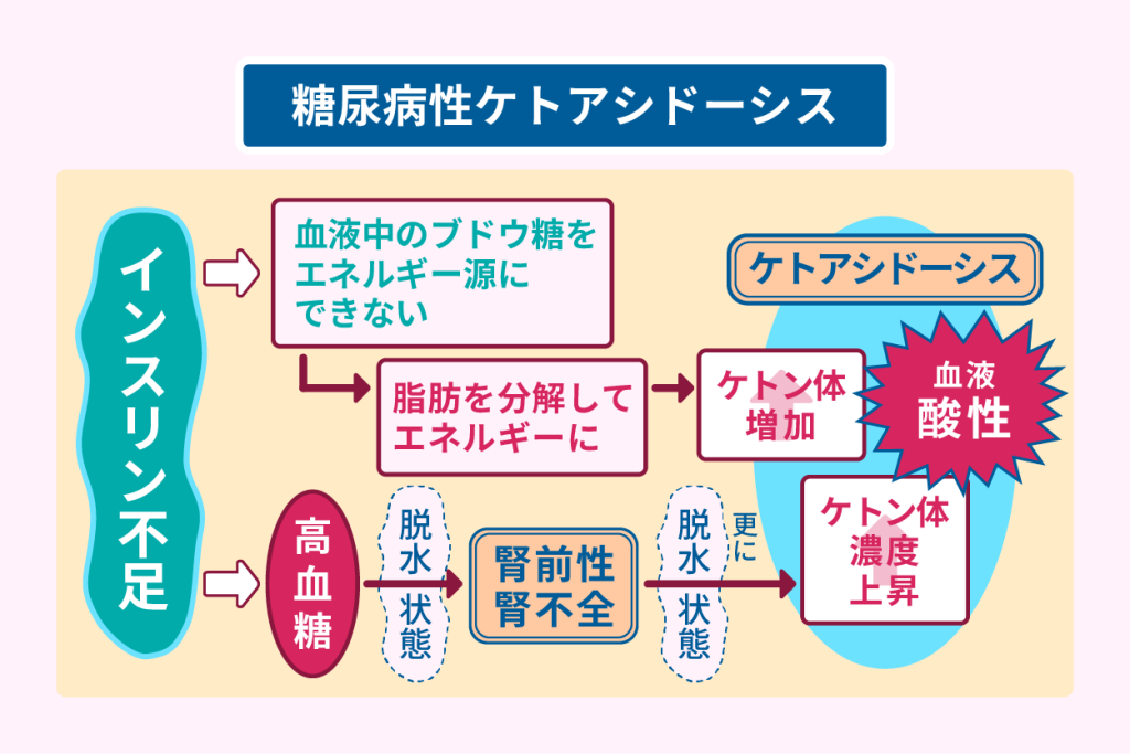 症例紹介【糖尿病性ケトアシドーシス】